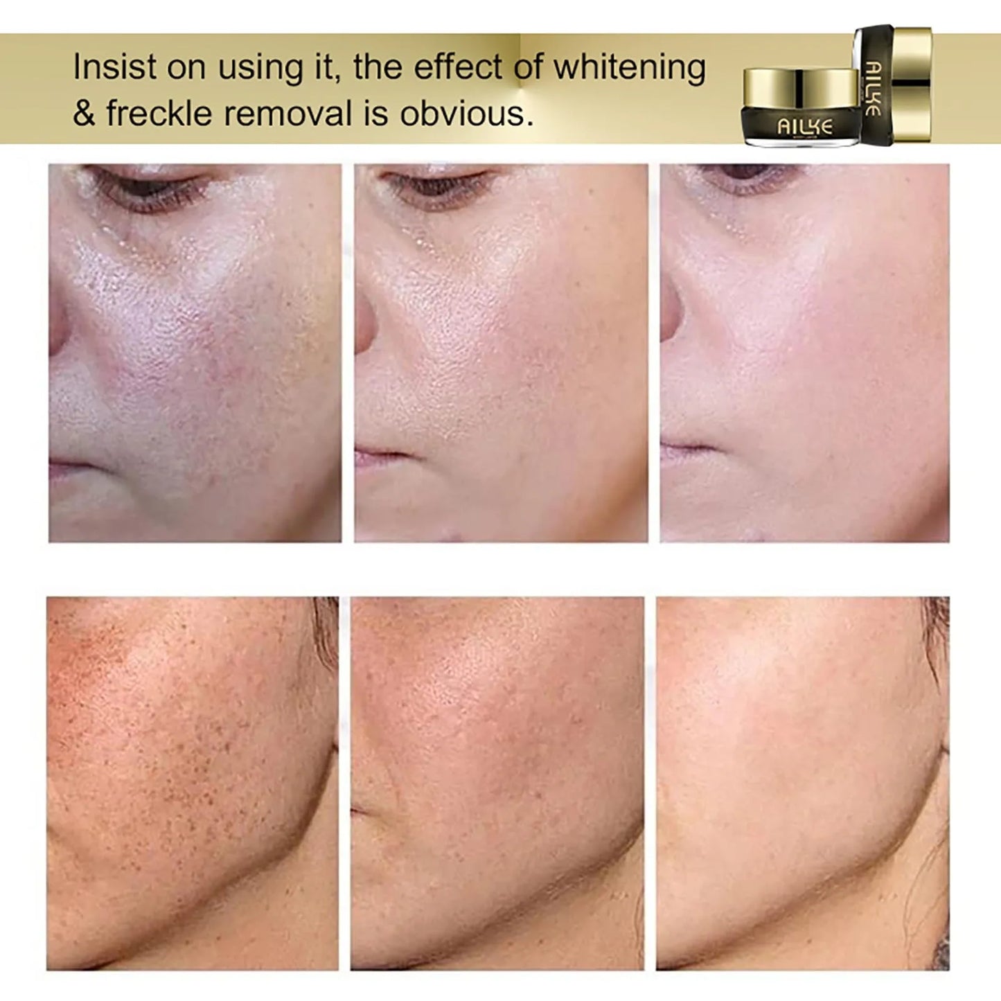 AILKE Lightening Face Cream for Dark Spots and Radiance