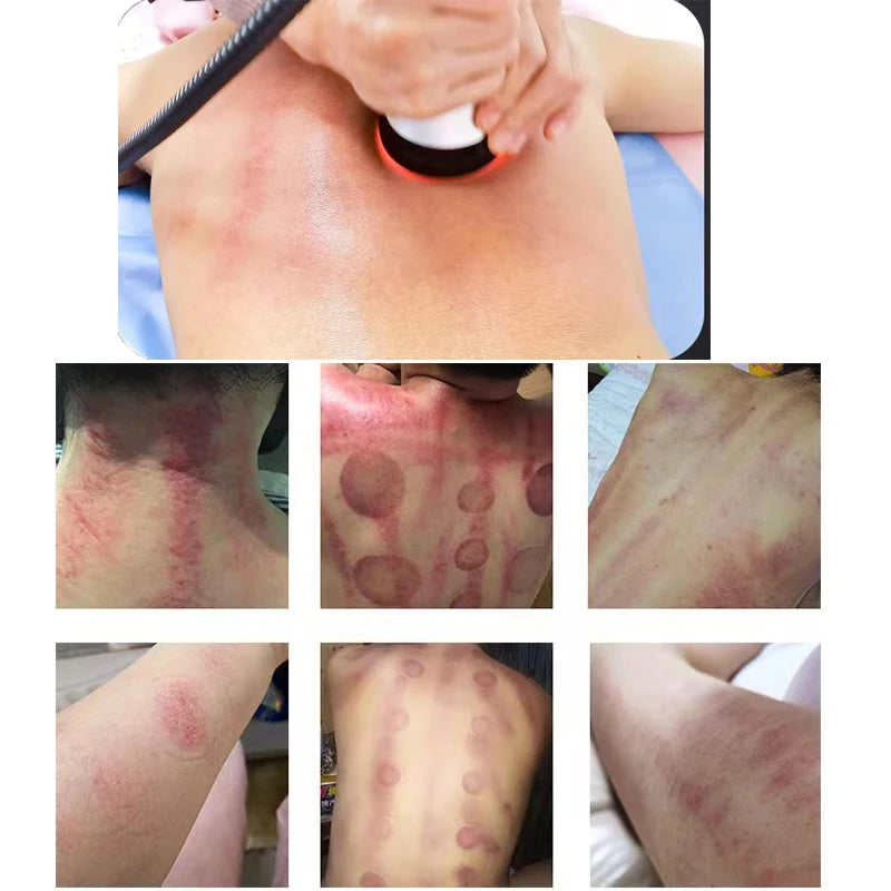 Moonic Beauty 4 In 1 Cavitation Ultrasonic Body Tool