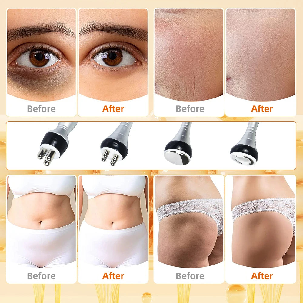 Moonic Beauty 4in1 Cavitation Body Slimming Vacuum Massager - Arthur's Wellness Emporium